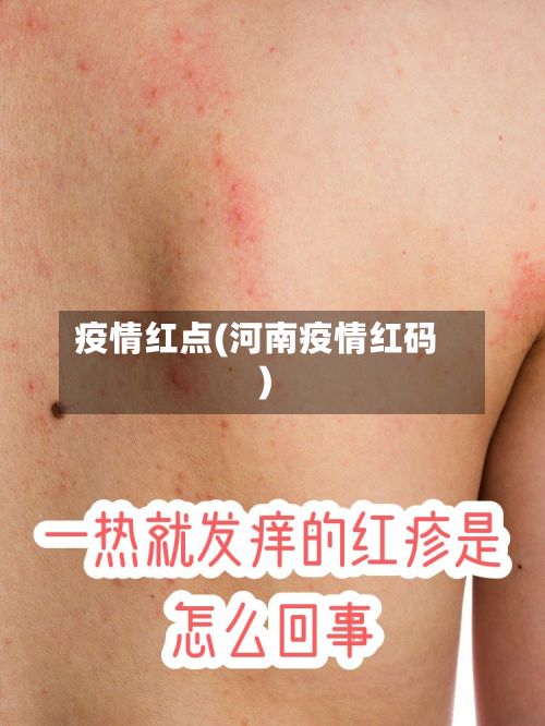 疫情红点(河南疫情红码)-第3张图片