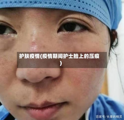 护肤疫情(疫情期间护士脸上的压痕)