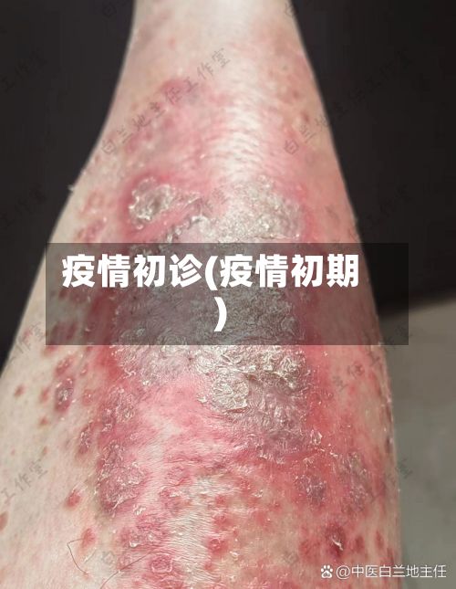 疫情初诊(疫情初期)