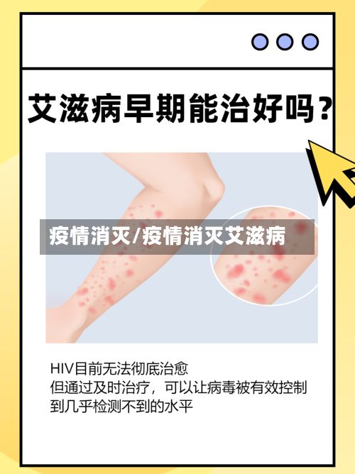疫情消灭/疫情消灭艾滋病-第2张图片